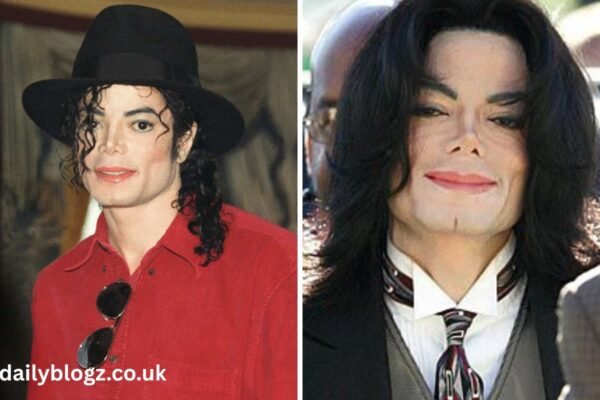 how did michael jackson die