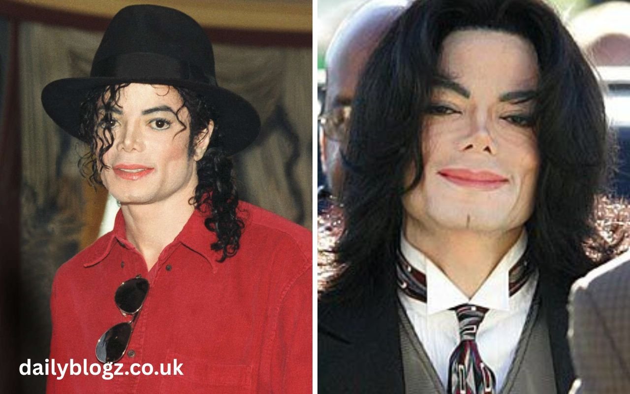 how did michael jackson die